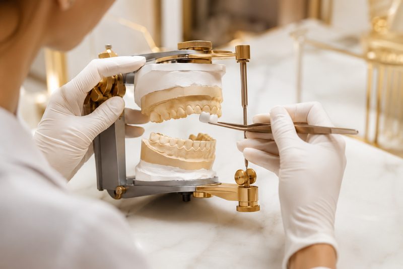Coronas y carillas de cerámica en laboratorio dental